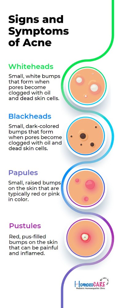 Signs And Symptoms Of Acne